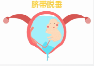 孕婦臍帶先露！阜陽市婦女兒童醫(yī)院婦產(chǎn)急救中心爭分奪秒，護(hù)佑母嬰安全！