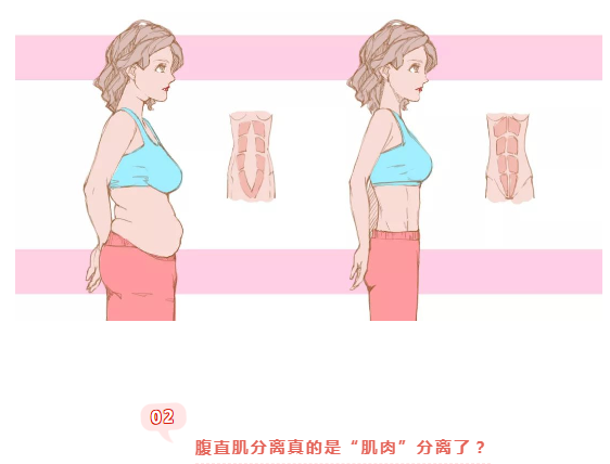 不當(dāng)產(chǎn)后“大腹婆”，你的腹直肌還好嗎？