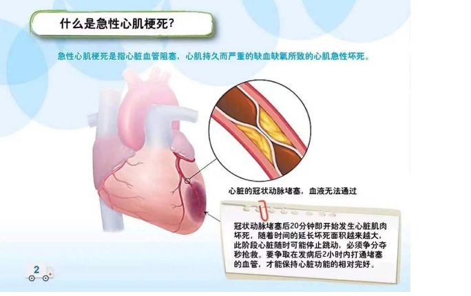 驚心動魄，多學科聯(lián)動，成功挽回心跳驟?；颊呱?！