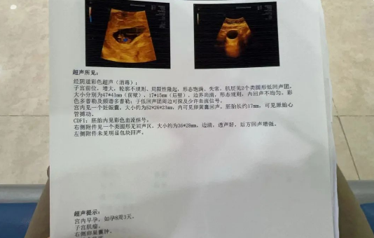 阜陽市婦女兒童醫(yī)院首例準“海扶寶寶”，歡迎你的到來！