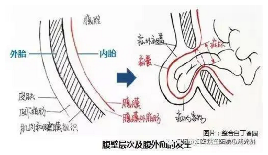 娃娃得了疝氣不要怕，阜陽(yáng)市婦女兒童醫(yī)院小兒外科來(lái)幫您！